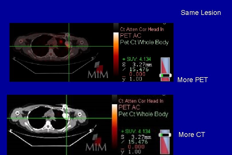 Same Lesion More PET More CT Same Lesion More PET More CT