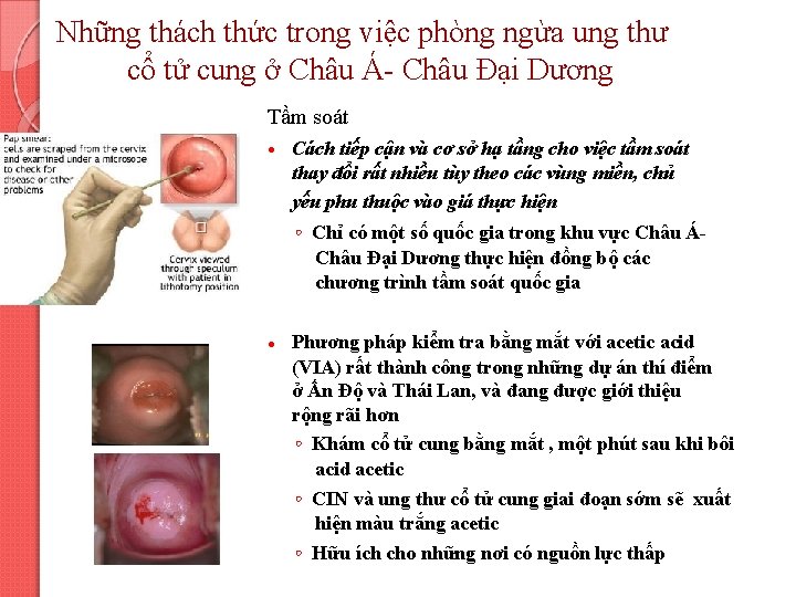 Những thách thức trong việc phòng ngừa ung thư cổ tử cung ở Châu
