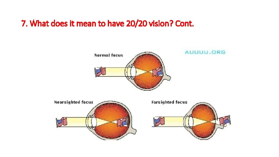 7. What does it mean to have 20/20 vision? Cont. 7. What does it mean to have 20/20 vision? Cont.