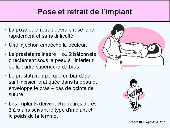 Pose et retrait de l’implant • La pose et le retrait devraient se faire