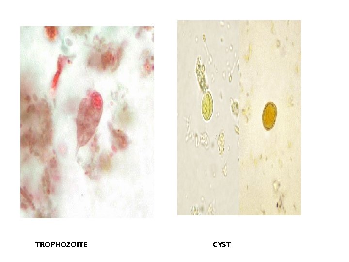 TROPHOZOITE CYST TROPHOZOITE CYST