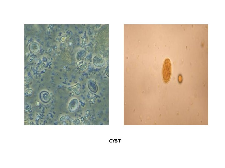 CYST CYST