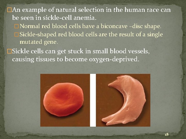 �An example of natural selection in the human race can be seen in sickle-cell