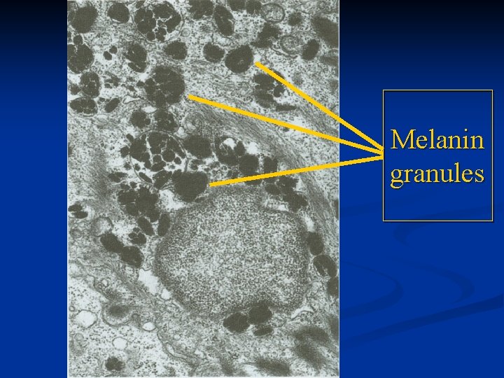 Melanin granules 