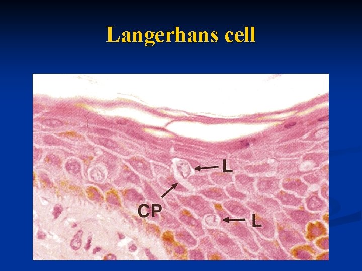 Langerhans cell 