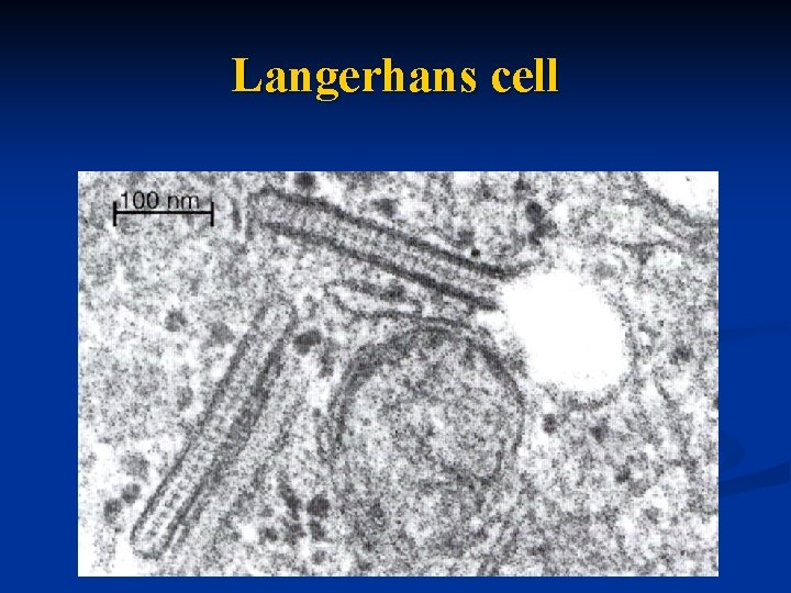 Langerhans cell 
