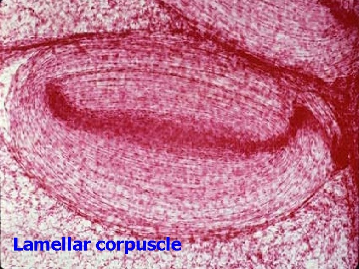 Lamellar corpuscle 