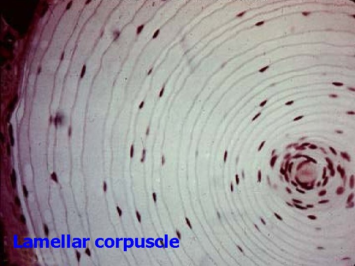 Lamellar corpuscle 