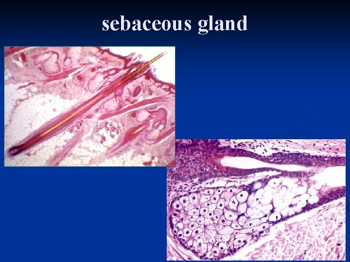 sebaceous gland 