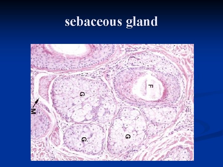 sebaceous gland 