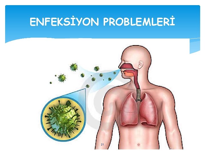 ENFEKSİYON PROBLEMLERİ 21 