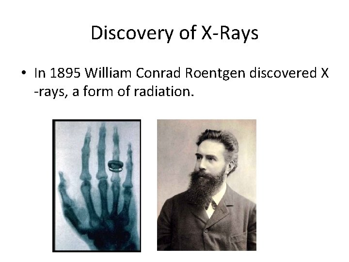 Discovery of X-Rays • In 1895 William Conrad Roentgen discovered X -rays, a form Discovery of X-Rays • In 1895 William Conrad Roentgen discovered X -rays, a form