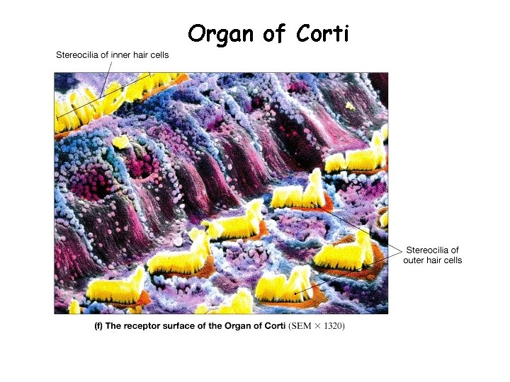 Organ of Corti 