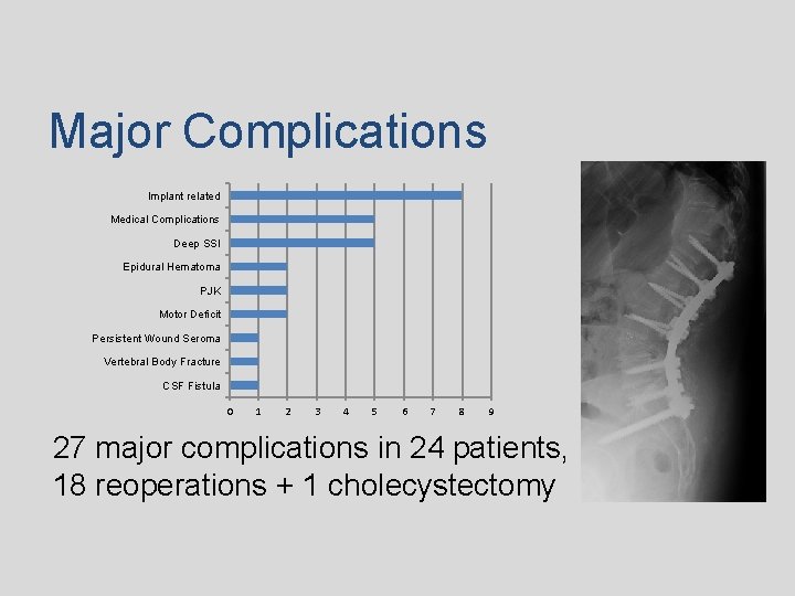 Major Complications Implant related Medical Complications Deep SSI Epidural Hematoma PJK Motor Deficit Persistent