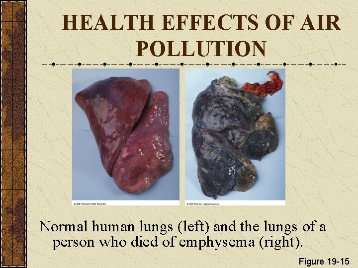 HEALTH EFFECTS OF AIR POLLUTION Normal human lungs (left) and the lungs of a
