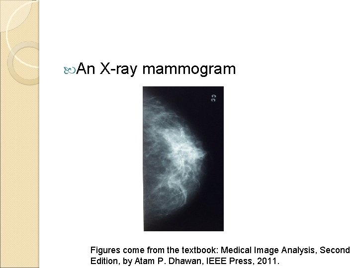  An X-ray mammogram Figures come from the textbook: Medical Image Analysis, Second Edition,