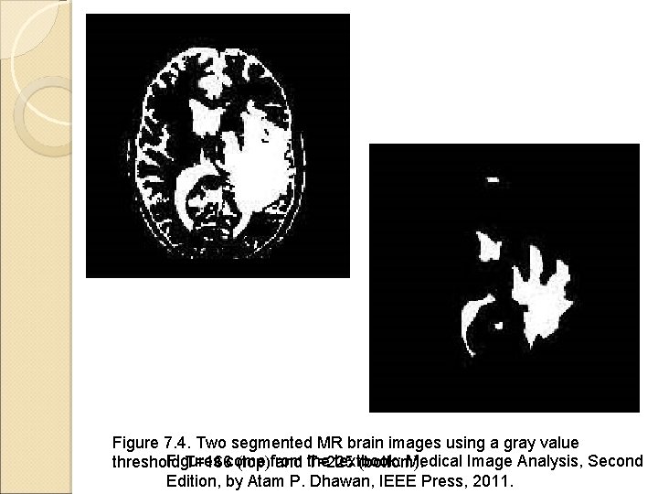 Figure 7. 4. Two segmented MR brain images using a gray value Figures the