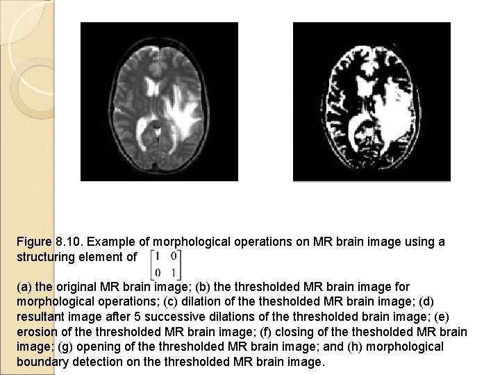 Figure 8. 10. Example of morphological operations on MR brain image using a structuring