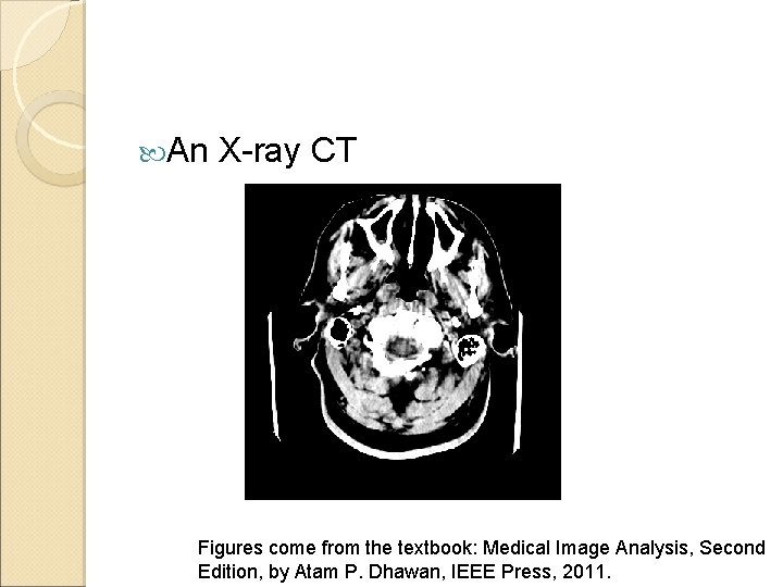  An X-ray CT Figures come from the textbook: Medical Image Analysis, Second Edition,