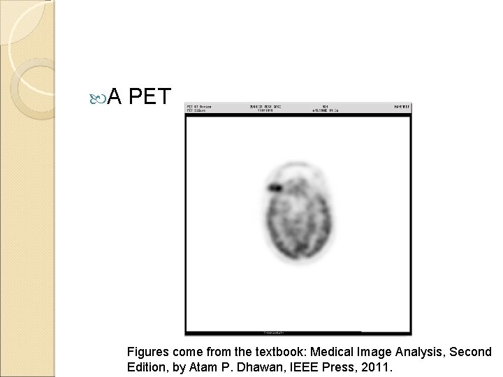  A PET Figures come from the textbook: Medical Image Analysis, Second Edition, by