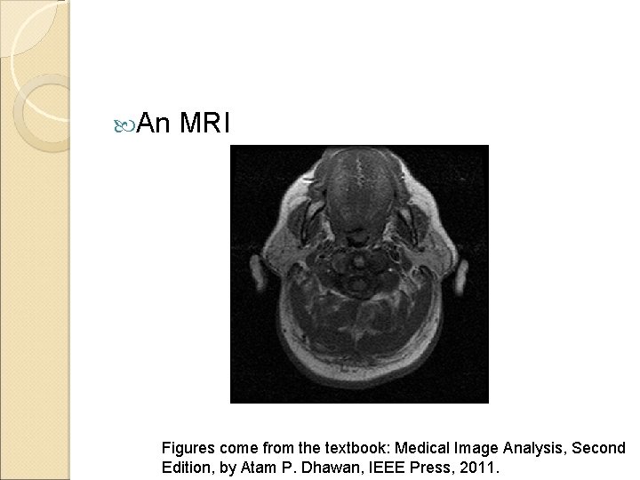  An MRI Figures come from the textbook: Medical Image Analysis, Second Edition, by