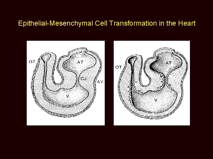 Epithelial-Mesenchymal Cell Transformation in the Heart 