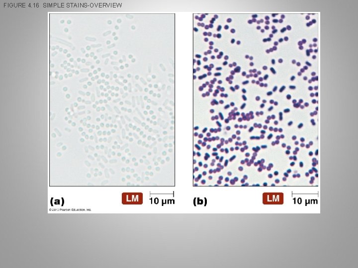 FIGURE 4. 16 SIMPLE STAINS-OVERVIEW 