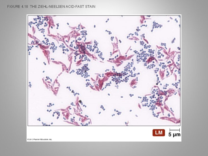 FIGURE 4. 18 THE ZIEHL-NEELSEN ACID-FAST STAIN 