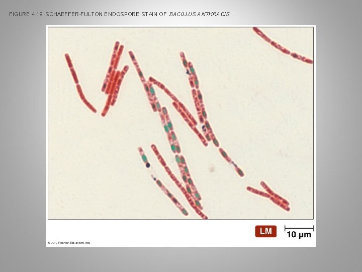 FIGURE 4. 19 SCHAEFFER-FULTON ENDOSPORE STAIN OF BACILLUS ANTHRACIS 