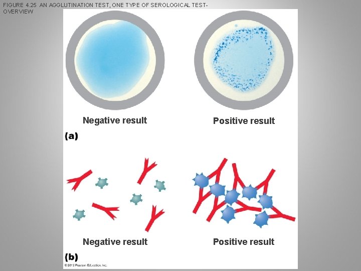 FIGURE 4. 25 AN AGGLUTINATION TEST, ONE TYPE OF SEROLOGICAL TESTOVERVIEW Negative result Positive