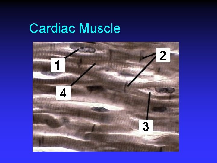 Cardiac Muscle 