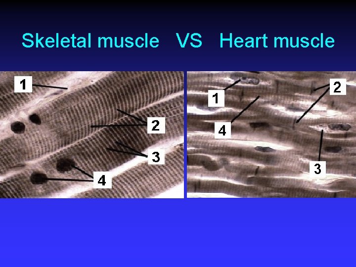 Skeletal muscle VS Heart muscle 