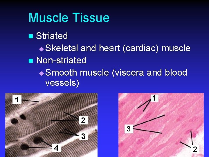 Muscle Tissue Striated u Skeletal and heart (cardiac) muscle n Non-striated u Smooth muscle