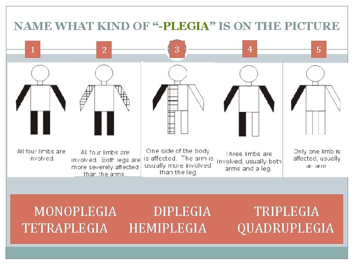 NAME WHAT KIND OF “-PLEGIA” IS ON THE PICTURE 1 2 3 4 5