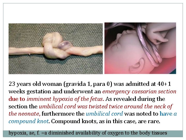 23 years old woman (gravida 1, para 0) was admitted at 40+1 weeks gestation