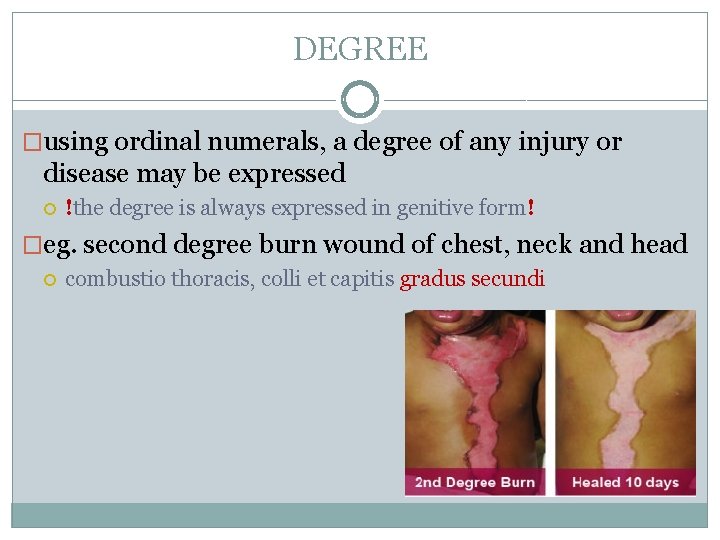 DEGREE �using ordinal numerals, a degree of any injury or disease may be expressed