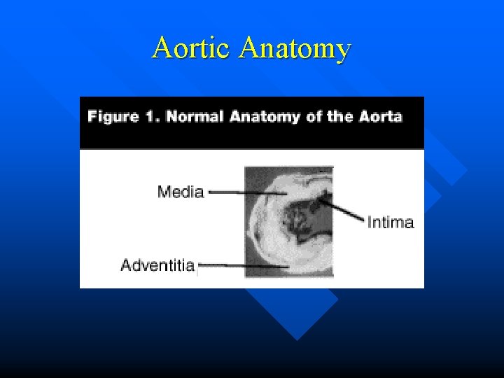 Aortic Anatomy 