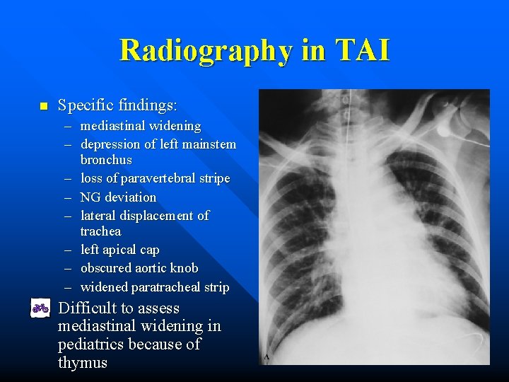 Radiography in TAI n Specific findings: – mediastinal widening – depression of left mainstem