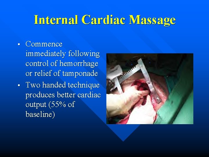 Internal Cardiac Massage Commence immediately following control of hemorrhage or relief of tamponade •