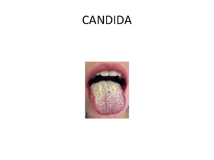 CANDIDA 
