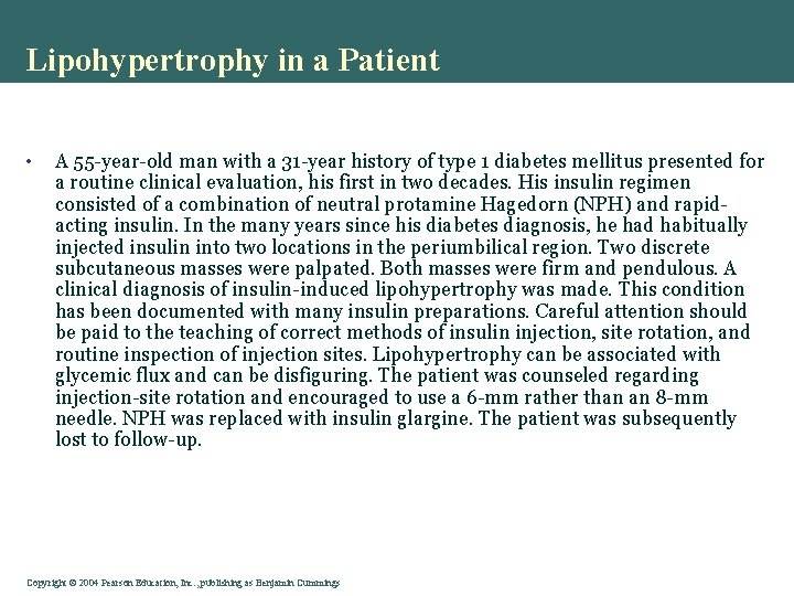 Lipohypertrophy in a Patient • A 55 -year-old man with a 31 -year history