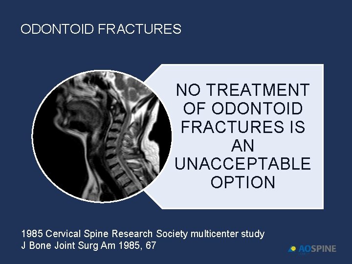 ODONTOID FRACTURES NO TREATMENT OF ODONTOID FRACTURES IS AN UNACCEPTABLE OPTION 1985 Cervical Spine