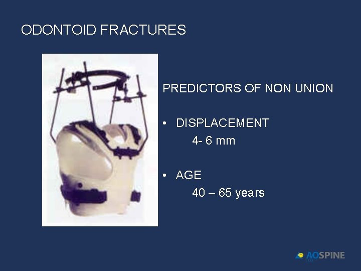 ODONTOID FRACTURES PREDICTORS OF NON UNION • DISPLACEMENT 4 - 6 mm • AGE