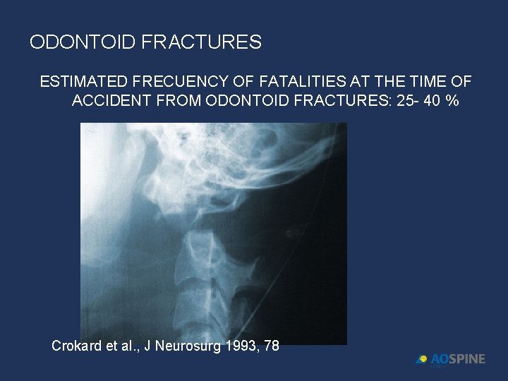 ODONTOID FRACTURES ESTIMATED FRECUENCY OF FATALITIES AT THE TIME OF ACCIDENT FROM ODONTOID FRACTURES: