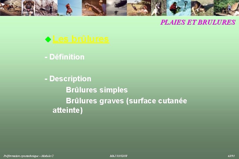 PLAIES ET BRULURES u Les brûlures - Définition - Description Brûlures simples Brûlures graves