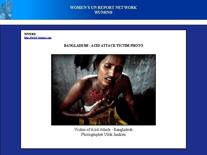 WOMEN’S UN REPORT NETWORK WUNRN® WUNRN http: //www. wunrn. com BANGLADESH - ACID ATTACK