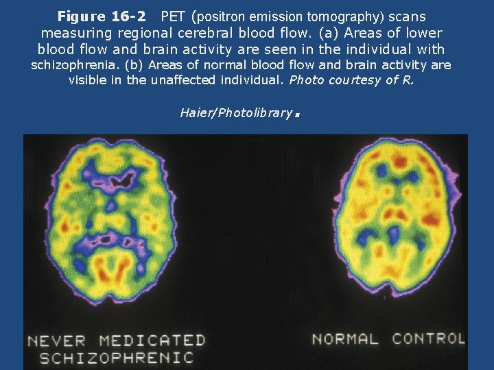 Figure 16 -2 PET (positron emission tomography) scans measuring regional cerebral blood flow. (a)