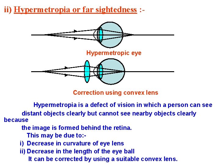 hipermetropie 2 leziuni oculare tratament