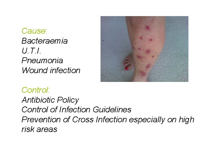 Cause: Bacteraemia U. T. I. Pneumonia Wound infection Control: Antibiotic Policy Control of Infection