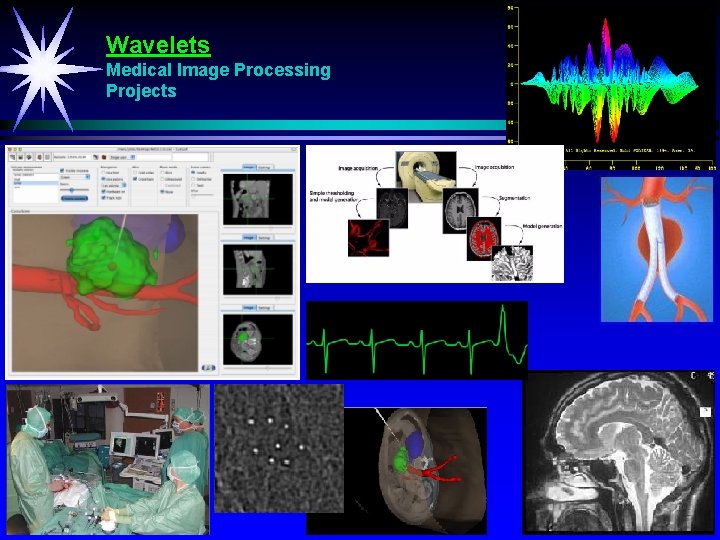 Wavelets Medical Image Processing Projects 